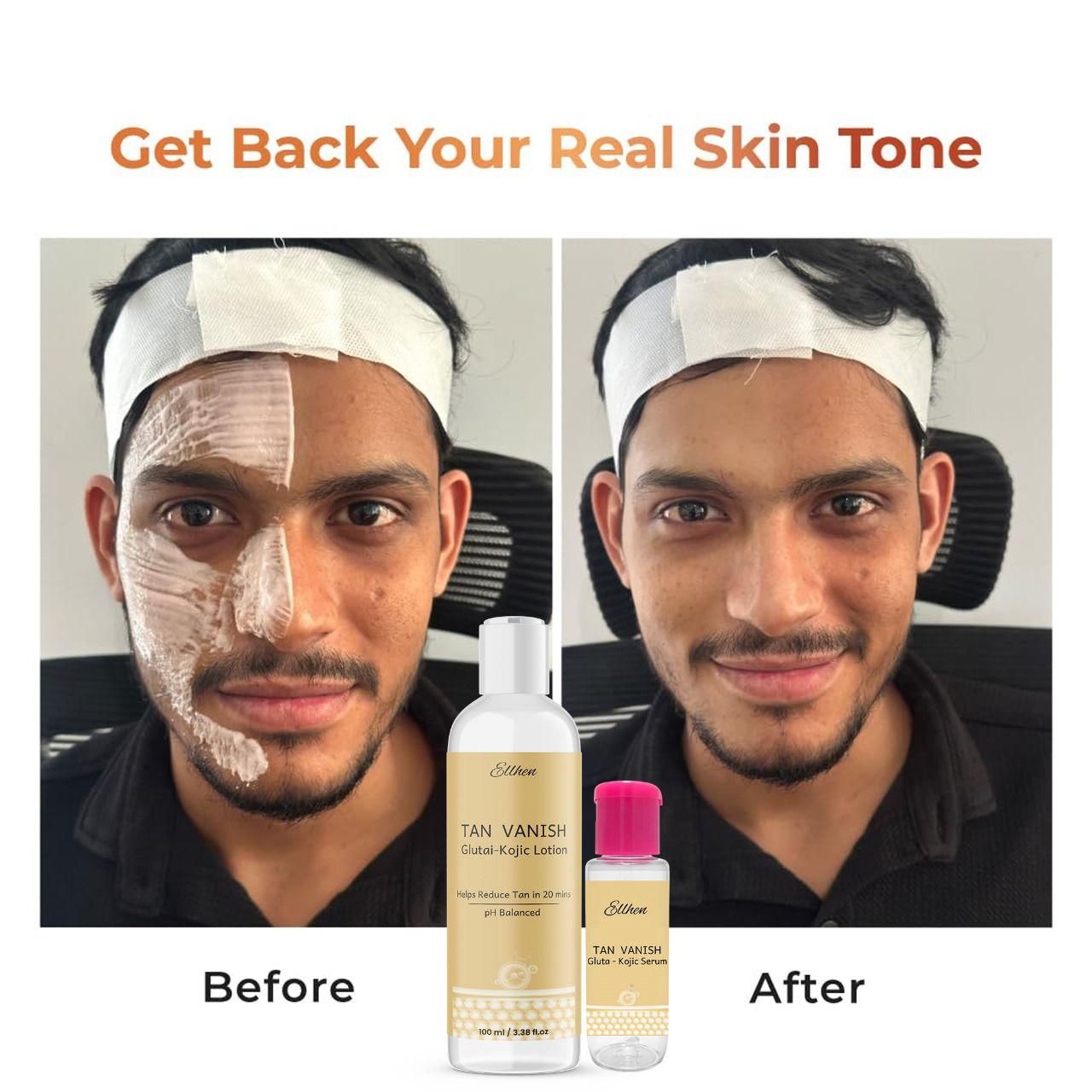 Tan Vanish Gluta-Kojic Skin Polish