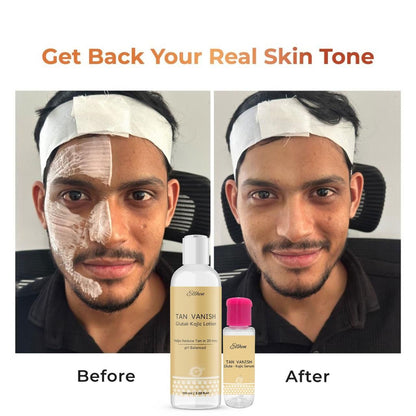 Tan Vanish Gluta-Kojic Skin Polish