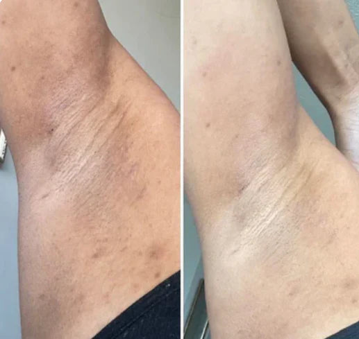 Peel Shot™ Skin Brightening Kojic Acid Turmeric Exfoliating Spray - old