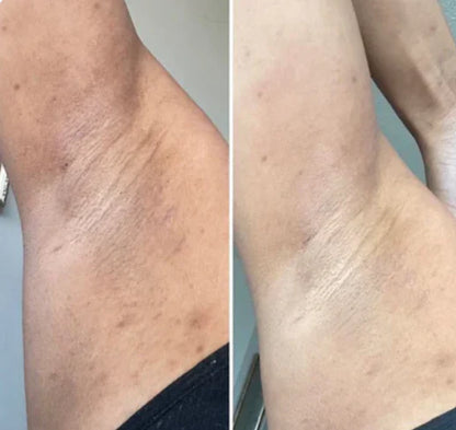 Peel Shot™ Skin Brightening Kojic Acid Turmeric Exfoliating Spray - old