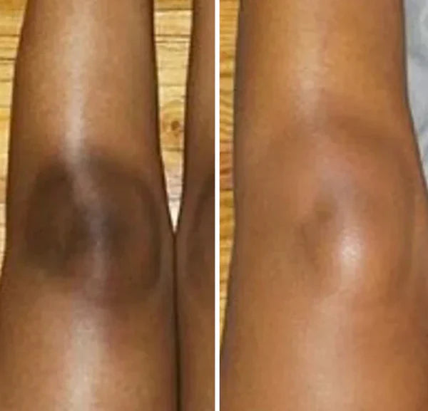 Peel Shot™ Skin Brightening Kojic Acid Turmeric Exfoliating Spray - old