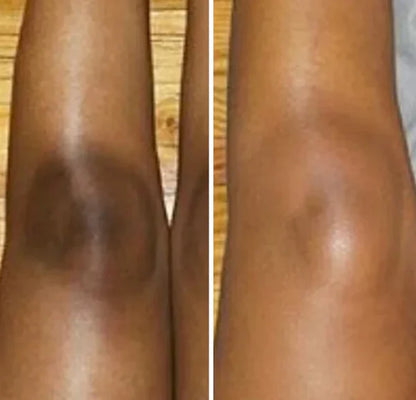 Peel Shot™ Skin Brightening Kojic Acid Turmeric Exfoliating Spray - old