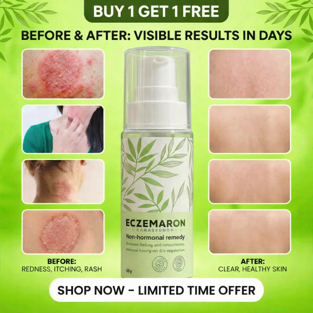 ORIGINAL Eczemaron Anti-Fungal Spray