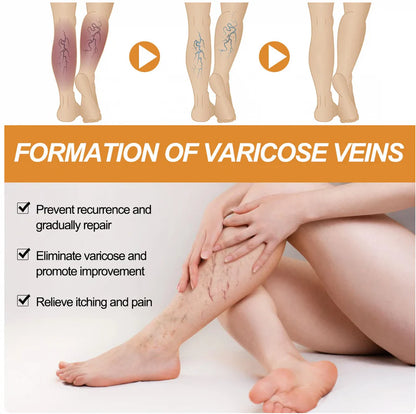Varicose Veins Treatment Spray (Buy 1 Get 1 Free)