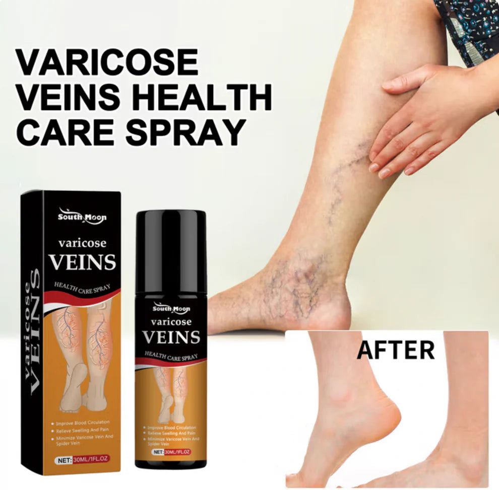 Varicose Veins Treatment Spray (Buy 1 Get 1 Free)