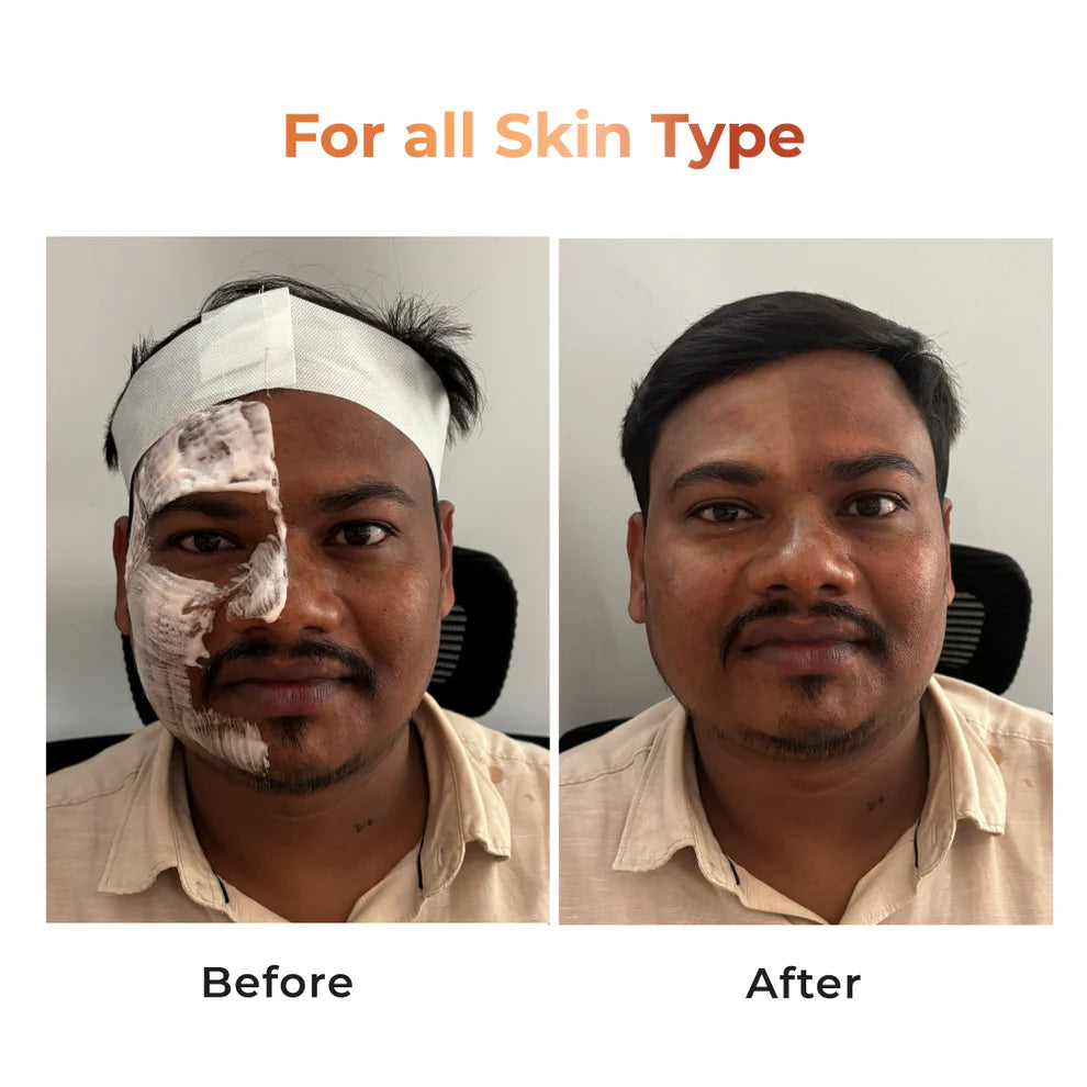 Tan Vanish Gluta-Kojic Skin Polish