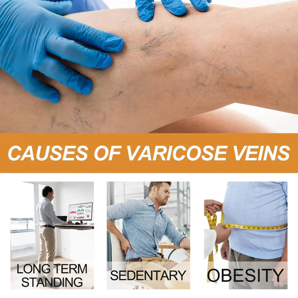 Varicose Veins Treatment Spray (Buy 1 Get 1 Free)