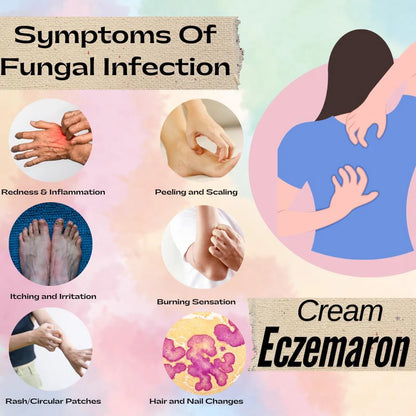 ORIGINAL Eczemaron Anti-Fungal Spray